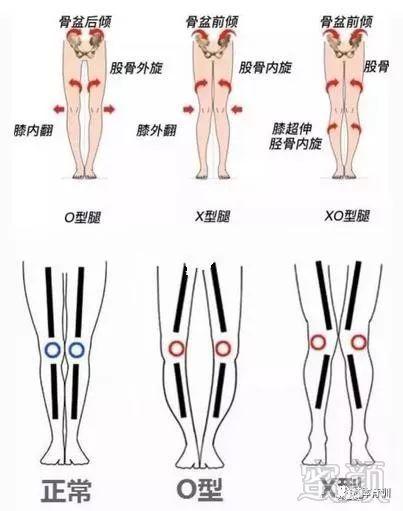 腿变直运动图解
