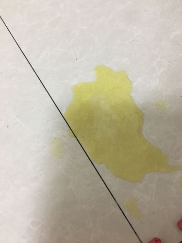 没吃东西吐了黄水怎么办