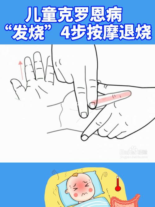 孩子高烧怎么推拿