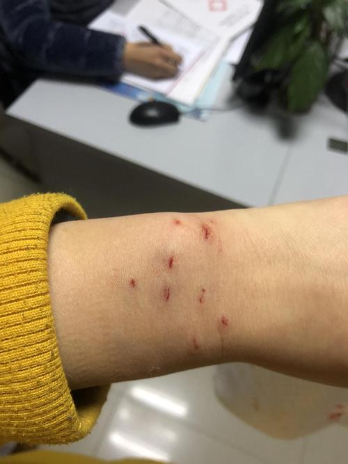 小猫突然乱咬东西怎么办