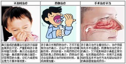 小孩子鼻炎怎么治疗