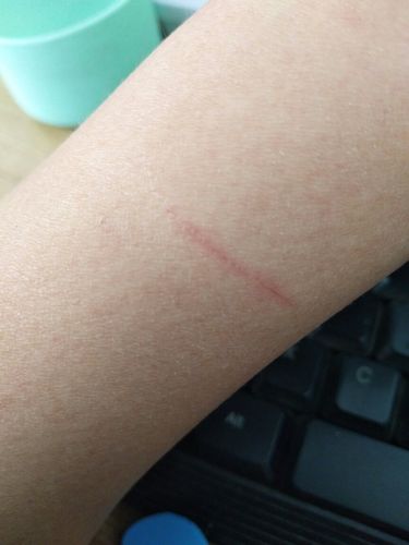 被猫抓了需要注意什么东西