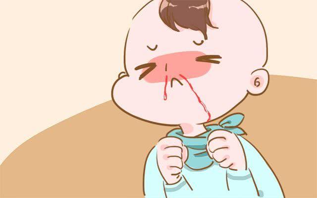 孩子上火流鼻血怎么办