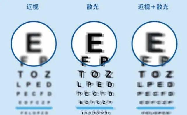 孩子高度散光怎么办