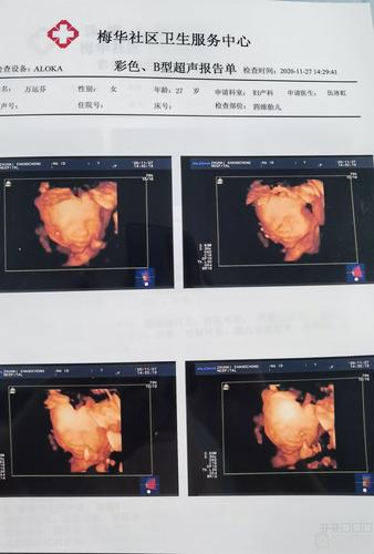 四维孩子不配合怎么办