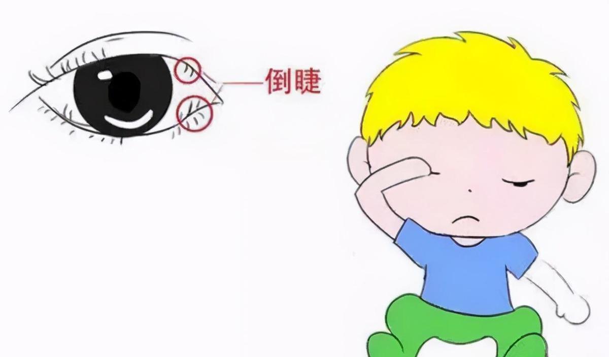 孩子频繁眨眼睛怎么办