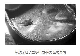 孩子误吞枣核怎么办