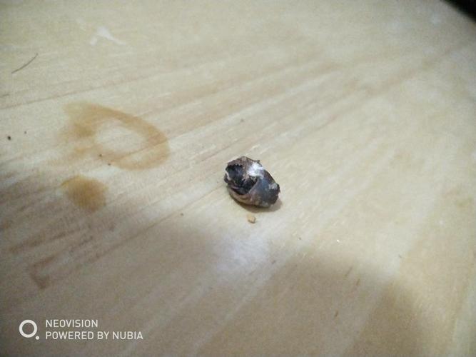 耳朵脏东西怎么弄出来怎么办