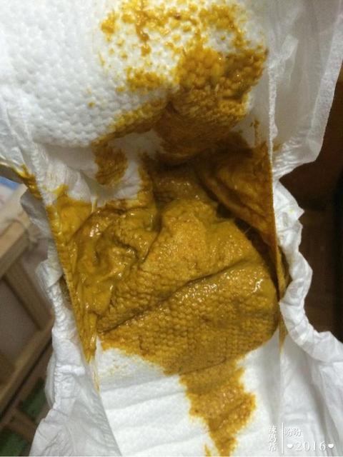 孩子好几天不拉屎怎么办