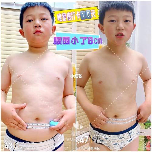 小孩子瘦怎么办