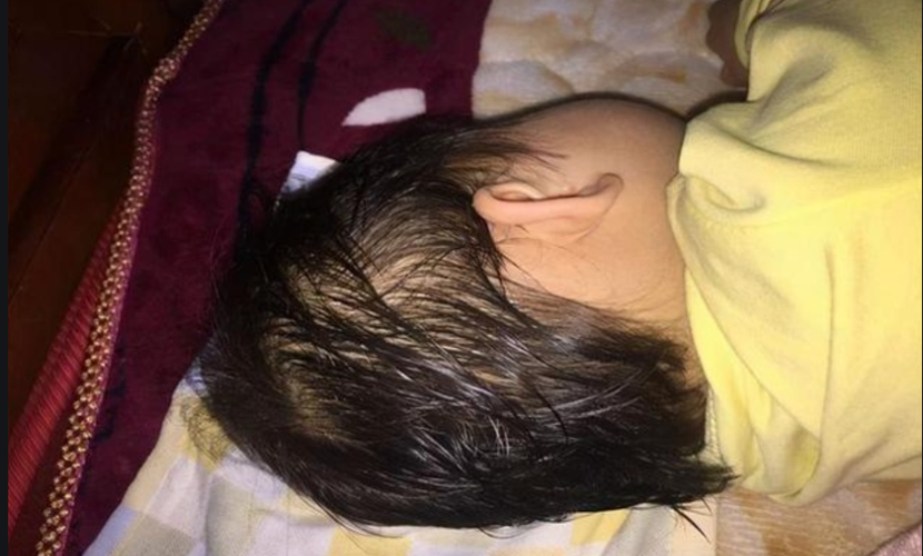 孩子后脑勺热怎么回事