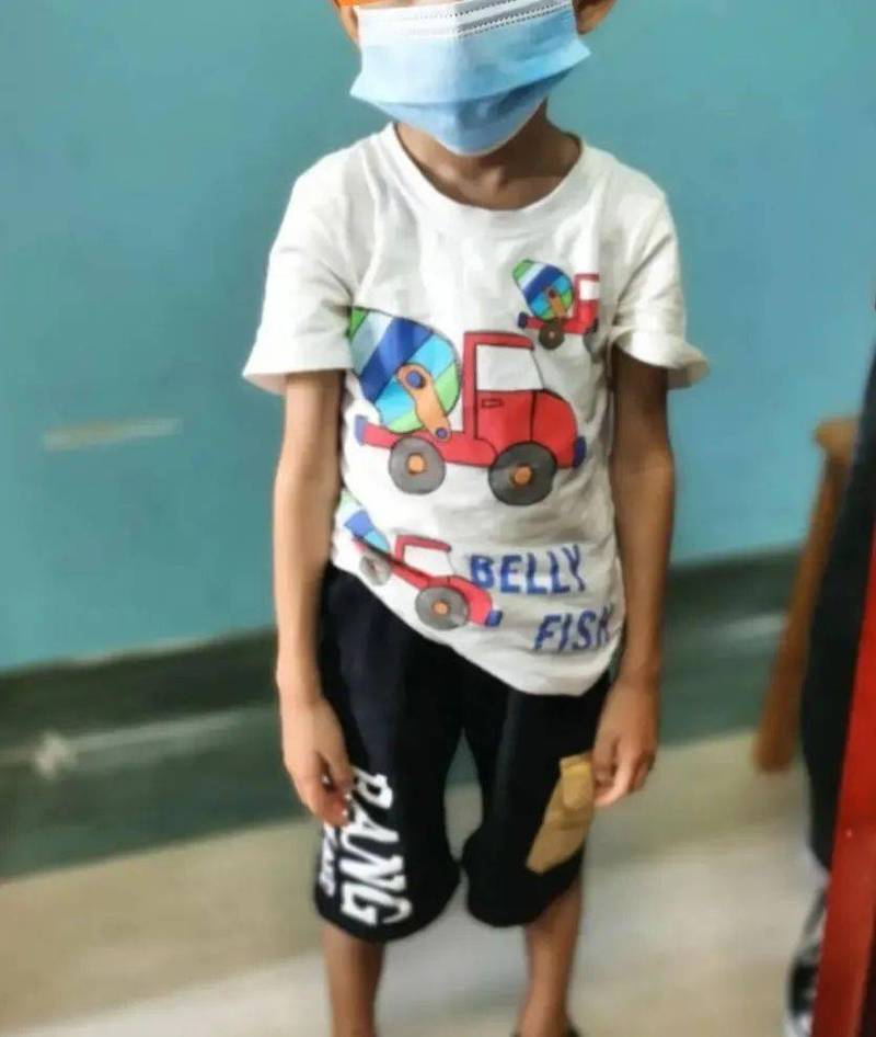 孩子瘦怎么办