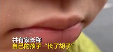 孩子长胡子怎么办