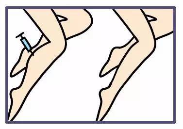粗盐瘦腿保鲜膜运动