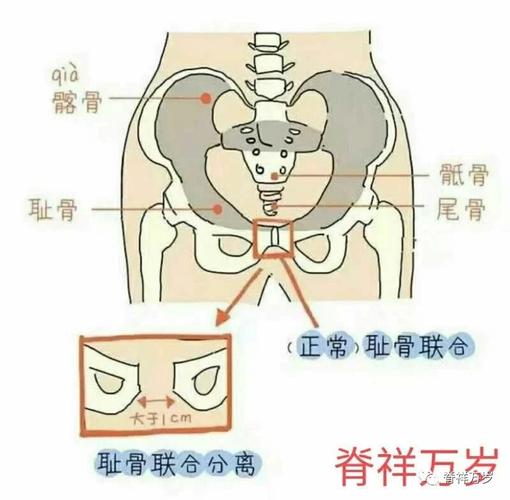 生完孩子尾骨疼怎么办