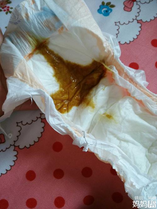 孩子有点拉肚子怎么办
