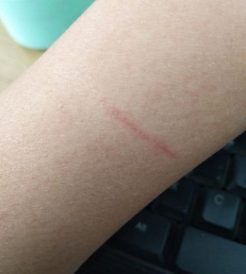 被猫抓了需要注意什么东西