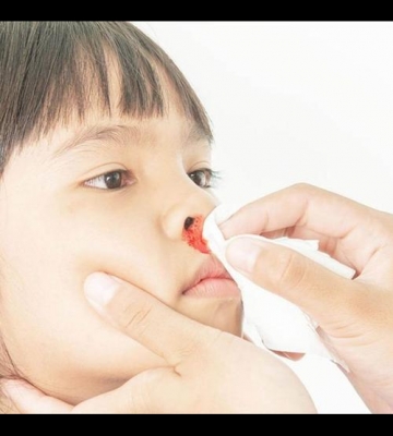 孩子鼻子老流血怎么回事