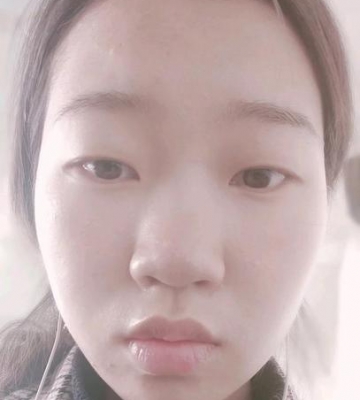 孩子鼻梁塌怎么办