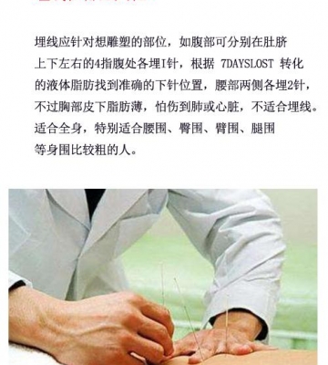 埋线减肥后运动