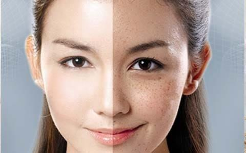 如何避免皮肤长斑