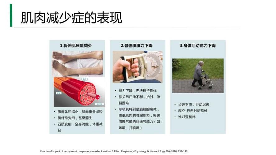 如何保护肌肉健康