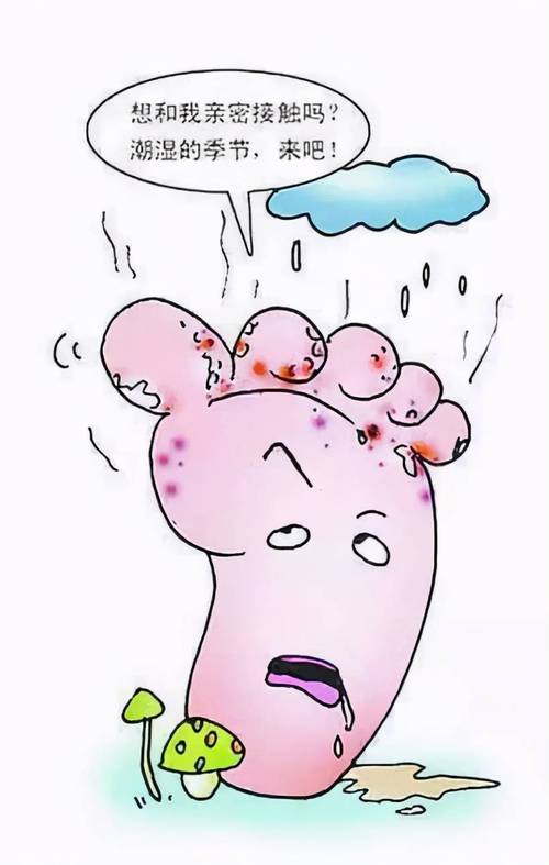 怎样预防脚气