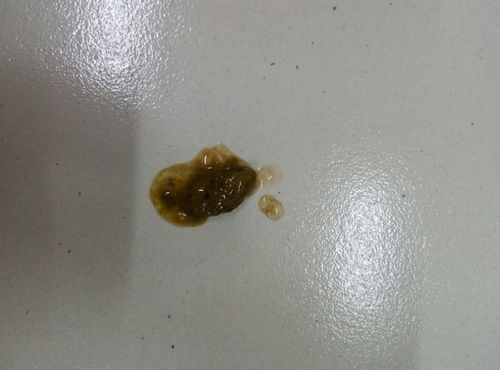 金毛便便有血是什么原因