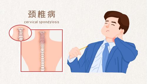 如何预防颈椎病