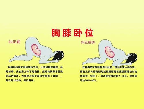 狗狗胎位不正怎么调整