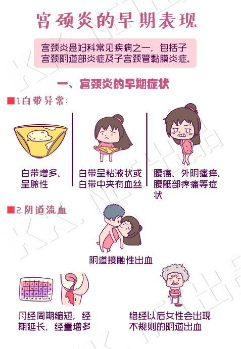 如何预防宫颈炎