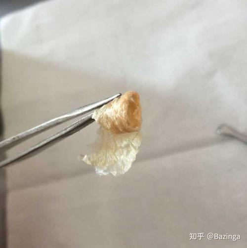 如何防止耳屎