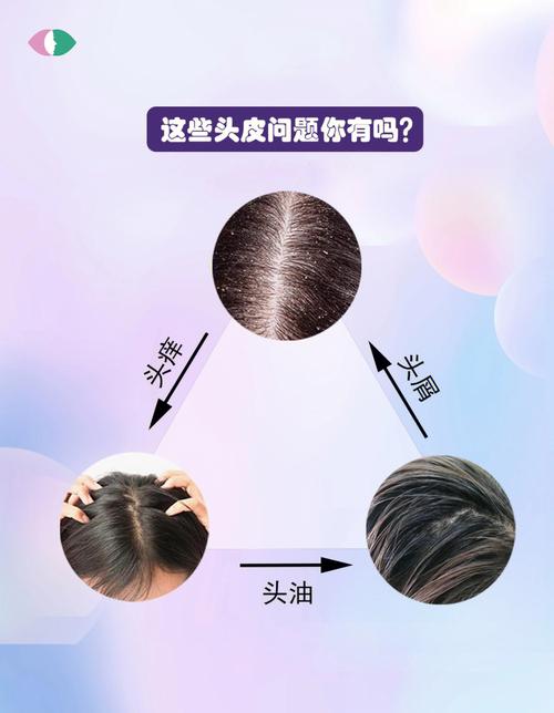 如何避免头皮问题