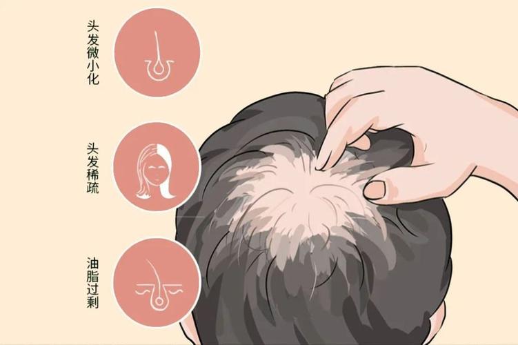 如何避免室内脱发