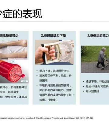 如何保护肌肉健康