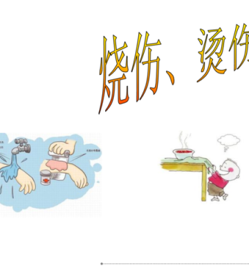如何防止被烧伤